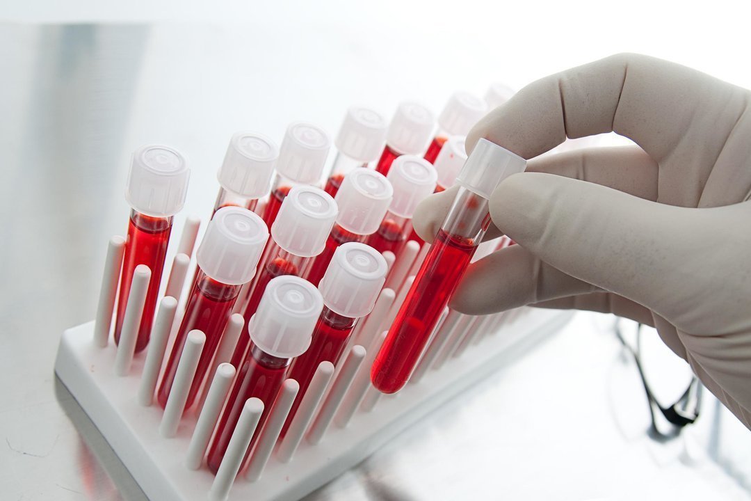 Что показывает биохимический анализ крови?