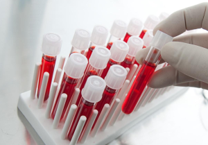 Биохимический анализ крови. Расшифровка результатов