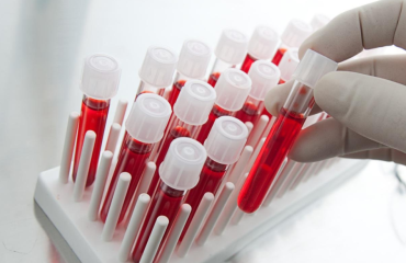 Биохимический анализ крови. Расшифровка результатов