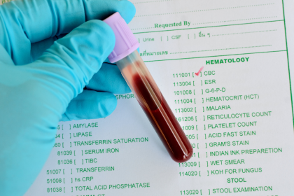 Биохимический анализ крови. В каких случаях назначается?